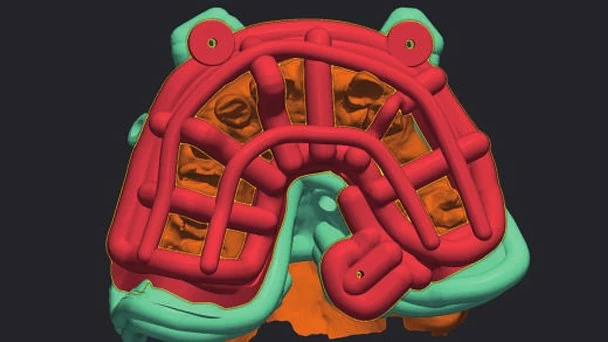Figure 13 from the published case