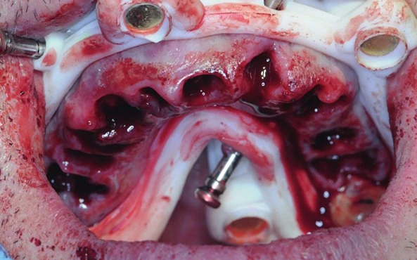 Figure 18 from the published case