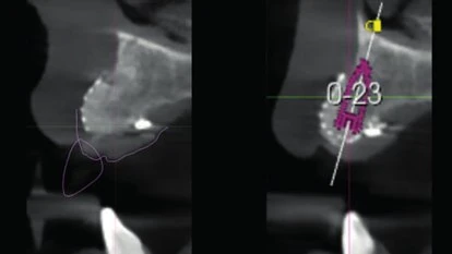 Figure 14 from the published case