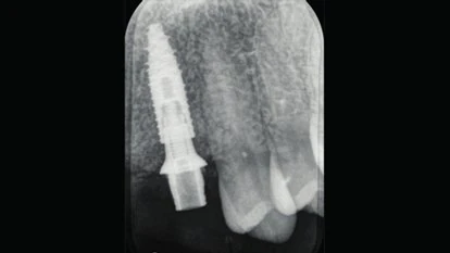 Figure 25 from the published case