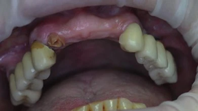 Figure 01 from the published case