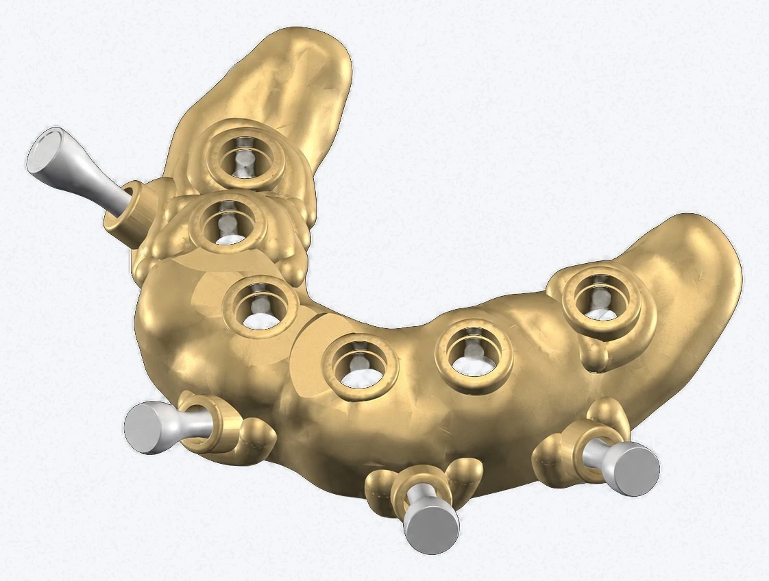A screw-retained full-arch framework on its multi-unit abutments, seen from above